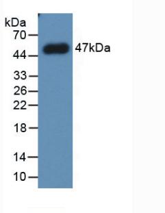 Monoclonal Antibody to Plasminogen Activator Inhibitor 1 (PAI1)