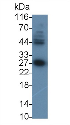 Monoclonal Antibody to Myelin Basic Protein (MBP)