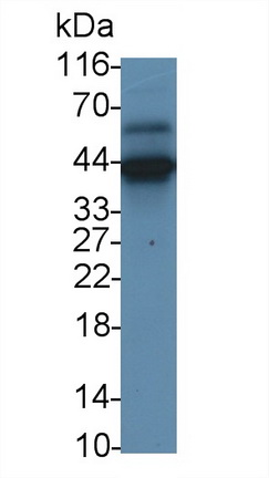 Monoclonal Antibody to Myelin Basic Protein (MBP)