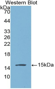 Monoclonal Antibody to Brain Natriuretic Peptide (BNP)