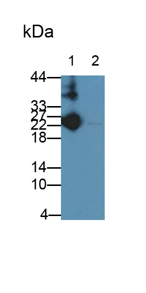 Monoclonal Antibody to Immunoglobulin G (IgG)