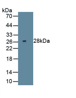 Monoclonal Antibody to Vascular Cell Adhesion Molecule 1 (VCAM1)