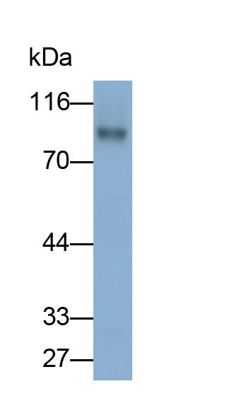 Monoclonal Antibody to Vascular Cell Adhesion Molecule 1 (VCAM1)