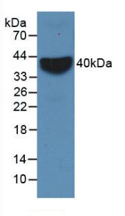 Monoclonal Antibody to Vascular Cell Adhesion Molecule 1 (VCAM1)