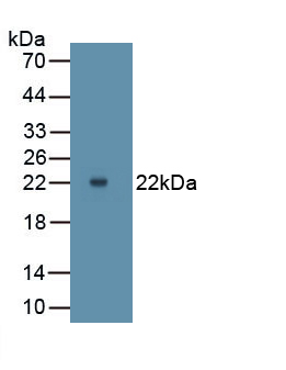 Monoclonal Antibody to Matrix Metalloproteinase 9 (MMP9)