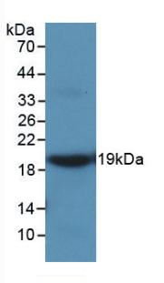 Monoclonal Antibody to Matrix Metalloproteinase 9 (MMP9)