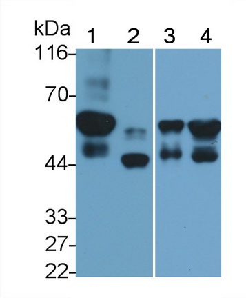 Monoclonal Antibody to Cytokeratin 7 (CK7)