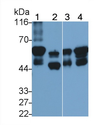 Monoclonal Antibody to Cytokeratin 7 (CK7)