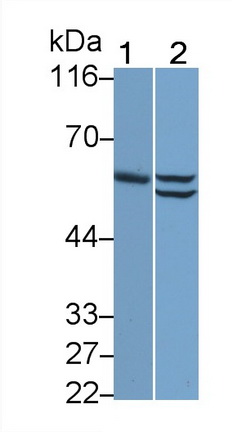 Monoclonal Antibody to Cytokeratin 7 (CK7)