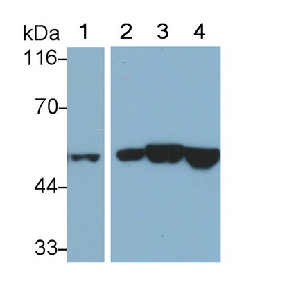 Monoclonal Antibody to Cytokeratin 7 (CK7)