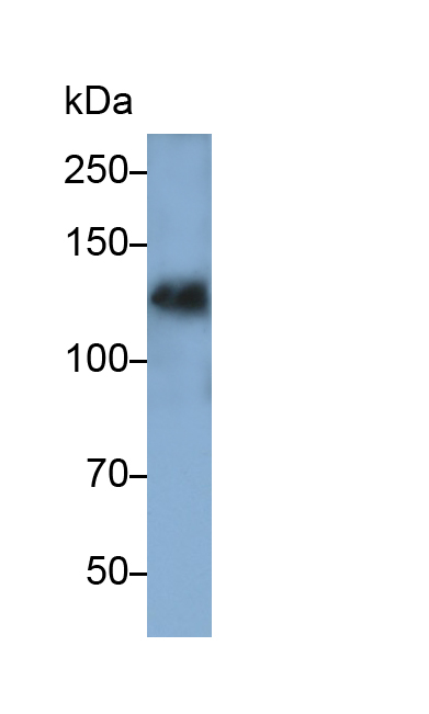 Monoclonal Antibody to Epidermal Growth Factor (EGF)