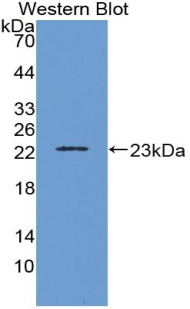 Monoclonal Antibody to Interleukin 1 Beta (IL1b)