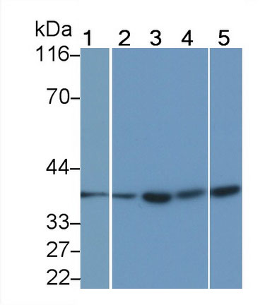 Monoclonal Antibody to Interleukin 1 Beta (IL1b)