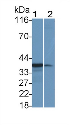 Monoclonal Antibody to Interleukin 1 Beta (IL1b)