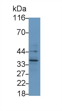 Monoclonal Antibody to Interleukin 1 Beta (IL1b)