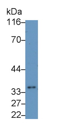 Monoclonal Antibody to Interleukin 1 Beta (IL1b)