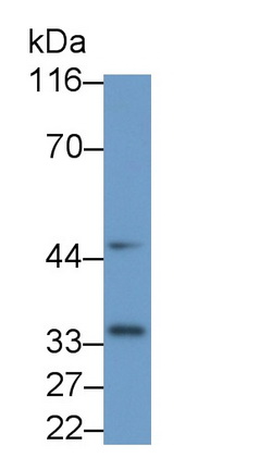 Monoclonal Antibody to Interleukin 1 Beta (IL1b)