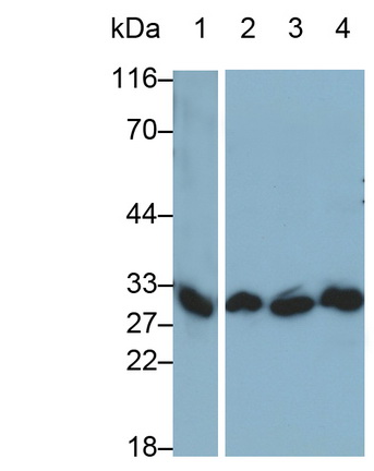 Monoclonal Antibody to Interleukin 1 Beta (IL1b)