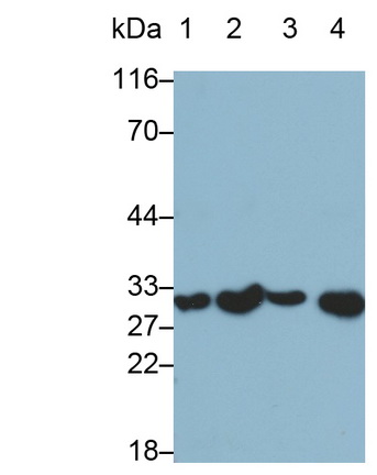 Monoclonal Antibody to Interleukin 1 Beta (IL1b)