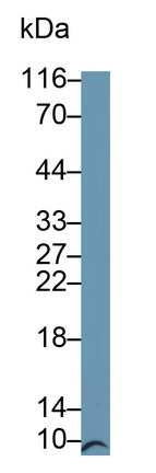 Monoclonal Antibody to S100 Calcium Binding Protein B (S100B)