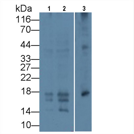 Monoclonal Antibody to Procollagen III N-Terminal Propeptide (PIIINP)