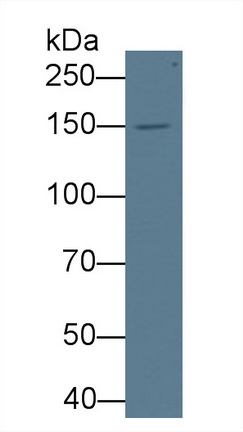 Monoclonal Antibody to Procollagen III N-Terminal Propeptide (PIIINP)