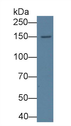 Monoclonal Antibody to Procollagen III N-Terminal Propeptide (PIIINP)