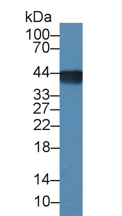 Monoclonal Antibody to Aquaporin 4 (AQP4)