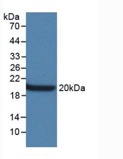 Monoclonal Antibody to Aquaporin 4 (AQP4)