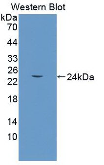 Monoclonal Antibody to Heme Oxygenase 1 (HO1)