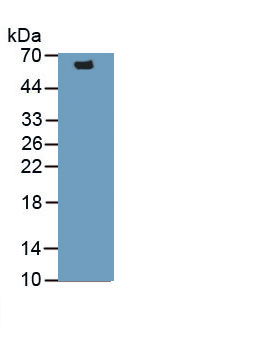 Monoclonal Antibody to Proliferating Cell Nuclear Antigen (PCNA)