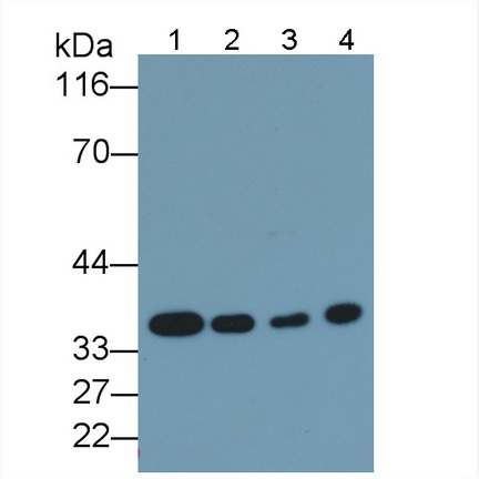 Monoclonal Antibody to Proliferating Cell Nuclear Antigen (PCNA)