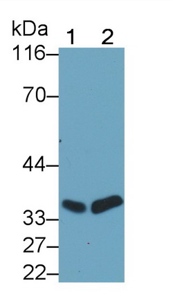 Monoclonal Antibody to Proliferating Cell Nuclear Antigen (PCNA)