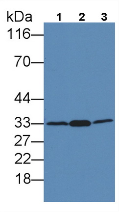 Monoclonal Antibody to Proliferating Cell Nuclear Antigen (PCNA)