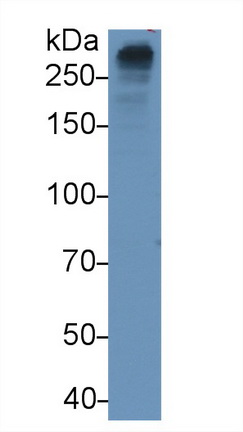 Monoclonal Antibody to Apolipoprotein <b>B100</b> (APO<b>B100</b>)