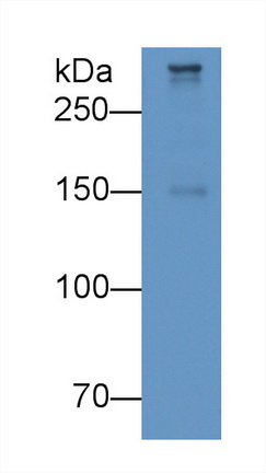 Monoclonal Antibody to Apolipoprotein B100 (APOB100)