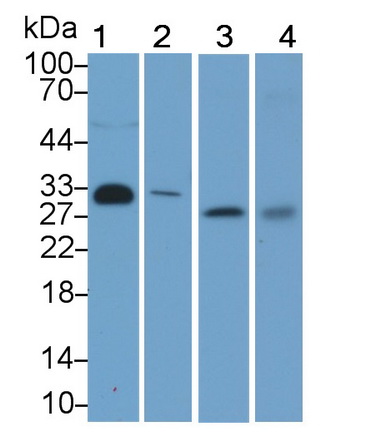 Monoclonal Antibody to Adiponectin (ADPN)