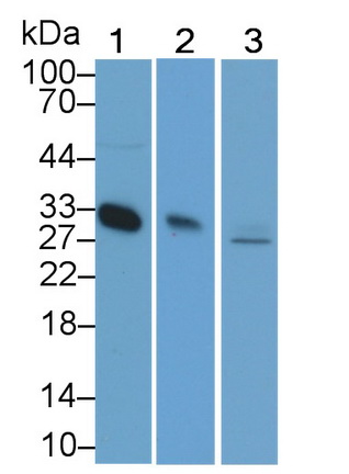 Monoclonal Antibody to Adiponectin (ADPN)