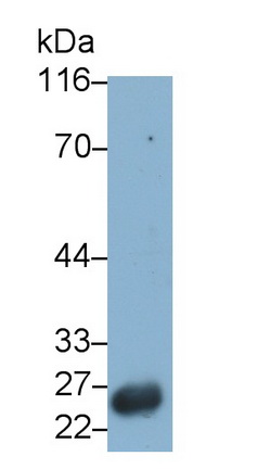 Monoclonal Antibody to Glutathione S Transferase Alpha 1 (GSTa1)