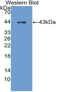 Monoclonal Antibody to Complement Factor H (CFH)