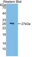 Monoclonal Antibody to Complement Factor H (CFH)