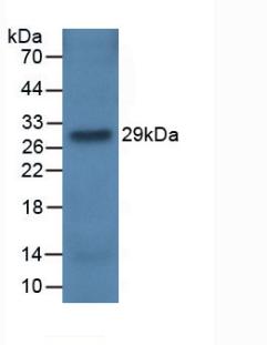 Monoclonal Antibody to Complement Factor H (CFH)