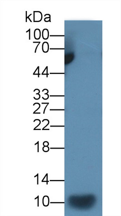 Monoclonal Antibody to Interleukin 7 (IL7)