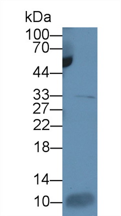 Monoclonal Antibody to Interleukin 7 (IL7)