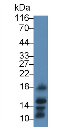 Monoclonal Antibody to Procalcitonin (PCT)