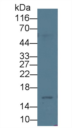 Monoclonal Antibody to Procalcitonin (PCT)