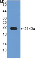 Monoclonal Antibody to Neuropilin 1 (NRP1)