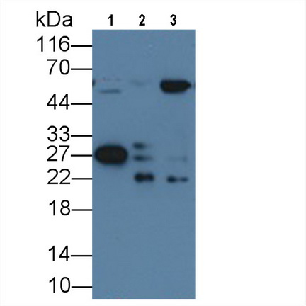 Monoclonal Antibody to Heat Shock Protein 27 (Hsp27)