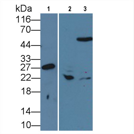 Monoclonal Antibody to Heat Shock Protein 27 (Hsp27)