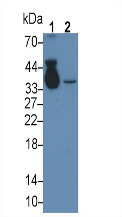 Monoclonal Antibody to Apolipoprotein E (APOE)